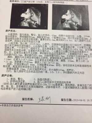 胎儿正常眼距(宝宝眼距离宽,其它没有发现什么) 第2张 胎儿正常眼距(宝宝眼距离宽,其它没有发现什么) 第2张