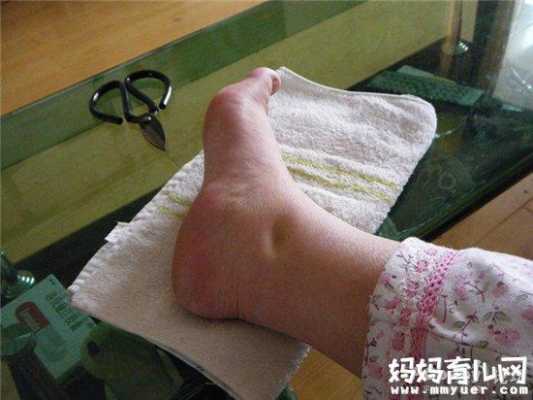 怀孕为什么脚会肿,怀孕脚肿怎么办,孕期脚肿腿肿如何缓解 第3张 怀孕为什么脚会肿,怀孕脚肿怎么办,孕期脚肿腿肿如何缓解 第3张