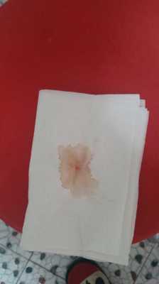 怀孕早期出少量血对胎儿发育有影响吗?要注意什么,早孕期间少量出血是怎么回事 第2张 怀孕早期出少量血对胎儿发育有影响吗?要注意什么,早孕期间少量出血是怎么回事 第2张