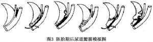 孕中期总感觉胎动已到尿道口是为什么,胎儿后尿道瓣膜是什么原因造成的 第3张 孕中期总感觉胎动已到尿道口是为什么,胎儿后尿道瓣膜是什么原因造成的 第3张