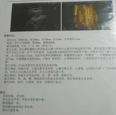 婴儿脊柱裂的症状有什么,胎儿脊柱裂超声表现报告单 第1张 婴儿脊柱裂的症状有什么,胎儿脊柱裂超声表现报告单 第1张