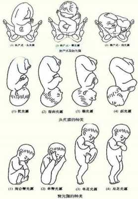 右骶前位胎儿图片(胎儿左骶前位是什么意思) 第3张 右骶前位胎儿图片(胎儿左骶前位是什么意思) 第3张