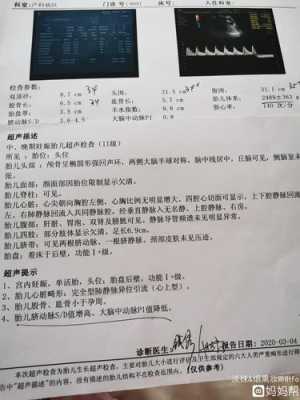 胎动经常在左边动,是什么原因啊,孕期左侧动脉阻力指数增高什么意思 第2张 胎动经常在左边动,是什么原因啊,孕期左侧动脉阻力指数增高什么意思 第2张