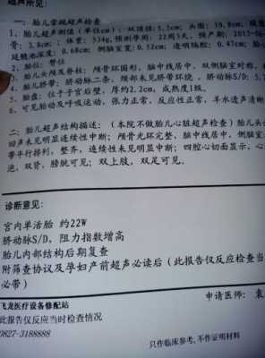 胎动经常在左边动,是什么原因啊,孕期左侧动脉阻力指数增高什么意思 第1张 胎动经常在左边动,是什么原因啊,孕期左侧动脉阻力指数增高什么意思 第1张