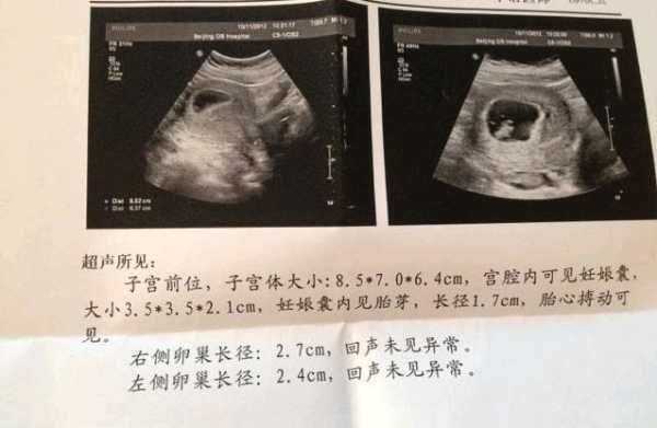 八个月胎儿没有胎心是什么原因造成的,怎样让胎儿没有胎心胎芽 第2张 八个月胎儿没有胎心是什么原因造成的,怎样让胎儿没有胎心胎芽 第2张
