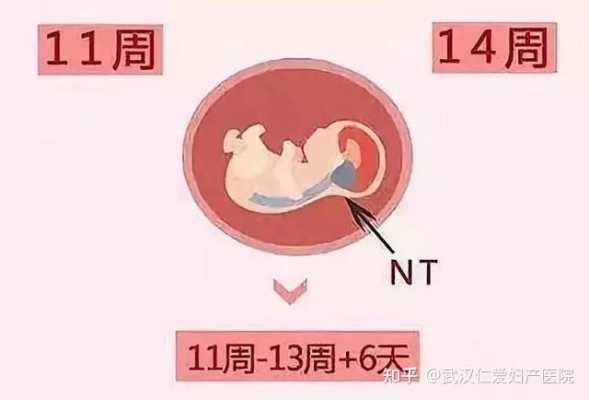 孕期畸形检查(孕期畸形检查什么时候) 第1张 孕期畸形检查(孕期畸形检查什么时候) 第1张