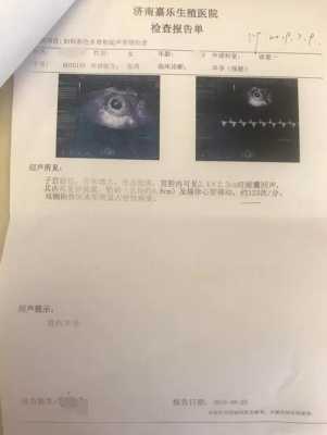 怀孕4个月胎心位置,四个月胎儿会动了吗? 第2张 怀孕4个月胎心位置,四个月胎儿会动了吗? 第2张