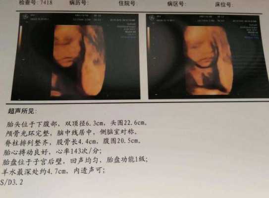 四维B超单上写着胎儿生物物理相评分8分是什么意思,胎儿八个月四维彩超图片 第2张 四维B超单上写着胎儿生物物理相评分8分是什么意思,胎儿八个月四维彩超图片 第2张
