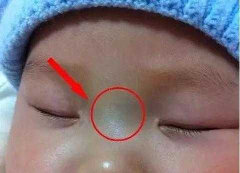 胎儿变黑吗（医生我家宝宝快八个月了眼下面发黑是什么原因）  第1张