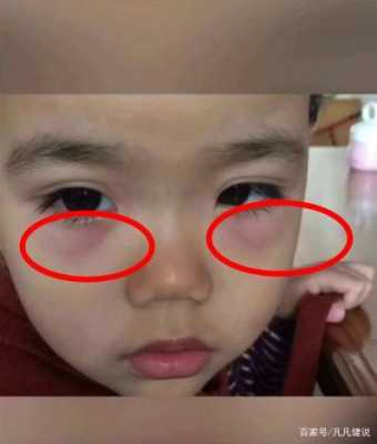 胎儿变黑吗（医生我家宝宝快八个月了眼下面发黑是什么原因）  第2张