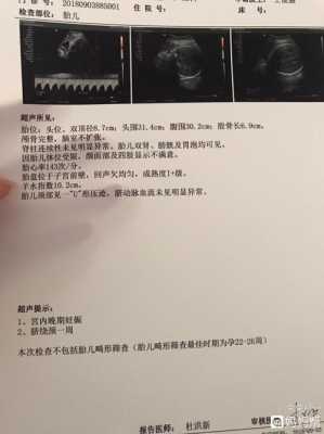 胎儿腿并着(胎儿腿并着看得出性别吗) 第2张 胎儿腿并着(胎儿腿并着看得出性别吗) 第2张