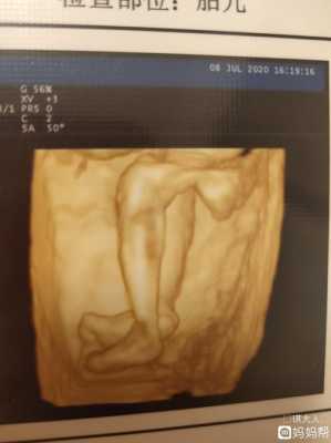两个月婴儿腿能并拢吗,胎儿并着腿可以看出男女吗 第3张 两个月婴儿腿能并拢吗,胎儿并着腿可以看出男女吗 第3张