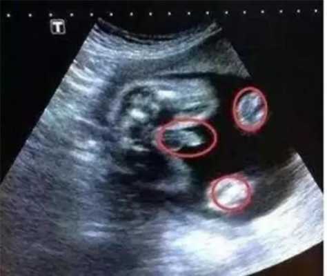 两个月婴儿腿能并拢吗,胎儿并着腿可以看出男女吗 第2张 两个月婴儿腿能并拢吗,胎儿并着腿可以看出男女吗 第2张