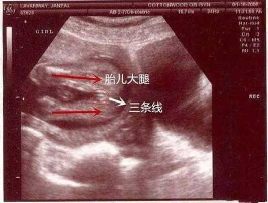 两个月婴儿腿能并拢吗,胎儿并着腿可以看出男女吗 第1张 两个月婴儿腿能并拢吗,胎儿并着腿可以看出男女吗 第1张