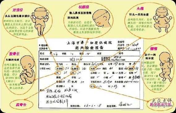 胎儿肱骨长是什么意思(想问一下,b超显示的股骨长是什么意思) 第3张 胎儿肱骨长是什么意思(想问一下,b超显示的股骨长是什么意思) 第3张