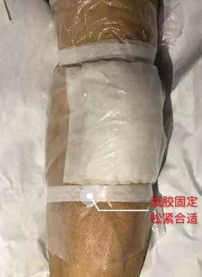 孕期阴部肿(孕期阴部肿胀如何使用硫酸镁敷) 第1张 孕期阴部肿(孕期阴部肿胀如何使用硫酸镁敷) 第1张