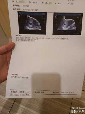 孕期6周(怀孕十三周加六是多少天了) 第1张 孕期6周(怀孕十三周加六是多少天了) 第1张