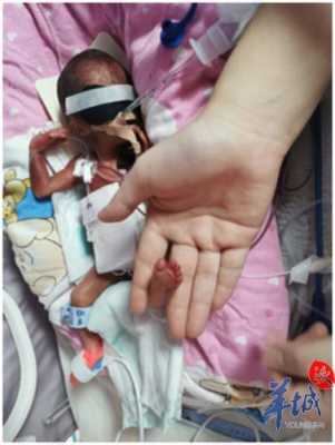 孕24周的胎儿图片(孕24周的胎儿图片大全) 第1张 孕24周的胎儿图片(孕24周的胎儿图片大全) 第1张