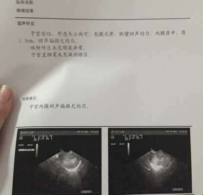 孕期两周(怀孕两周出血怎么办) 第2张 孕期两周(怀孕两周出血怎么办) 第2张