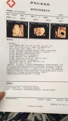 四维不过关是什么原因啊?刚做的检查了,这样胎儿会发育不好吗,做四维对胎儿有伤害吗视频 第2张 四维不过关是什么原因啊?刚做的检查了,这样胎儿会发育不好吗,做四维对胎儿有伤害吗视频 第2张