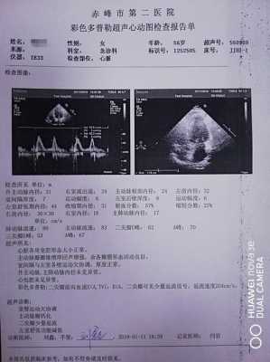 做胎儿心脏彩超要多少钱（做胎儿心脏彩超要多少钱一次）  第3张