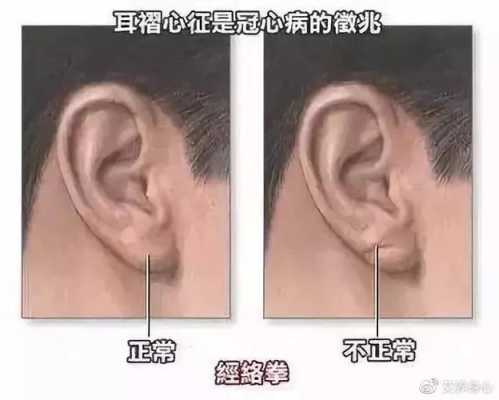 胎儿人中深(人中深浅代表生育力吗) 第2张 胎儿人中深(人中深浅代表生育力吗) 第2张