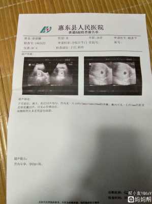 6周大胎儿(怀孕6周能多走路吗) 第1张 6周大胎儿(怀孕6周能多走路吗) 第1张