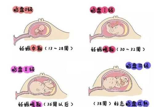 如何知道胎儿是否健康(如何知道胎儿是否健康) 第2张 如何知道胎儿是否健康(如何知道胎儿是否健康) 第2张