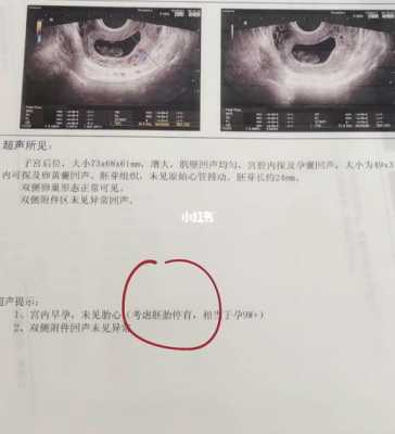 胎心正常胎儿就正常吗（胎心正常胎儿就正常吗会胎停吗）  第1张