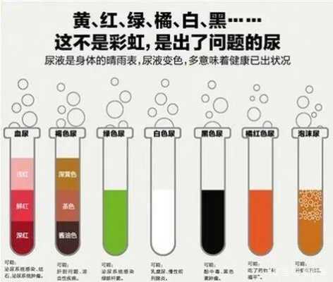孕期尿液很黄是怎么回事,孕期尿发黄是什么原因 第1张 孕期尿液很黄是怎么回事,孕期尿发黄是什么原因 第1张