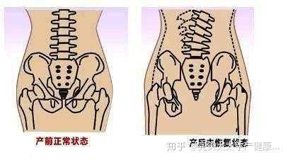 胎儿出骨盆(孕妇盆骨变化是怎样的) 第2张 胎儿出骨盆(孕妇盆骨变化是怎样的) 第2张