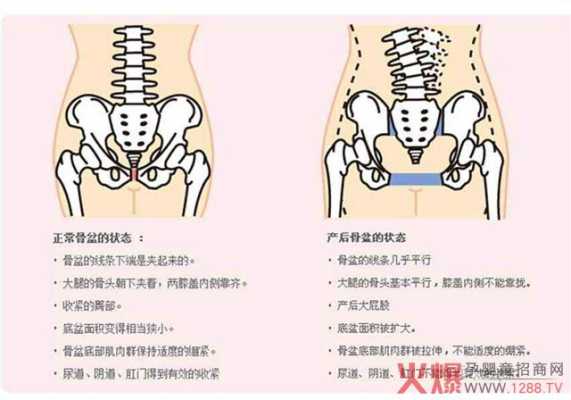 胎儿出骨盆(孕妇盆骨变化是怎样的) 第1张 胎儿出骨盆(孕妇盆骨变化是怎样的) 第1张