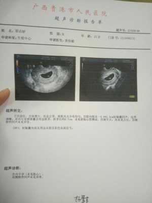 18周胎儿视频(怀孕18周胎心不好找是因为小孩在宫内到处跑吗) 第1张 18周胎儿视频(怀孕18周胎心不好找是因为小孩在宫内到处跑吗) 第1张