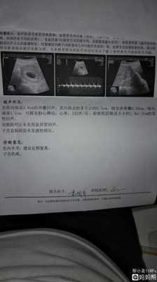 子宫肌瘤超三厘米能怀孕生孩子吗,子宫肌瘤多大影响胎儿发育 第2张 子宫肌瘤超三厘米能怀孕生孩子吗,子宫肌瘤多大影响胎儿发育 第2张