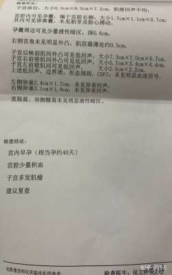 子宫肌瘤超三厘米能怀孕生孩子吗,子宫肌瘤多大影响胎儿发育 第1张 子宫肌瘤超三厘米能怀孕生孩子吗,子宫肌瘤多大影响胎儿发育 第1张