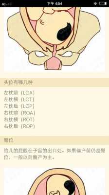 胎儿右枕后位图片(胎儿右枕后位图片) 第2张 胎儿右枕后位图片(胎儿右枕后位图片) 第2张