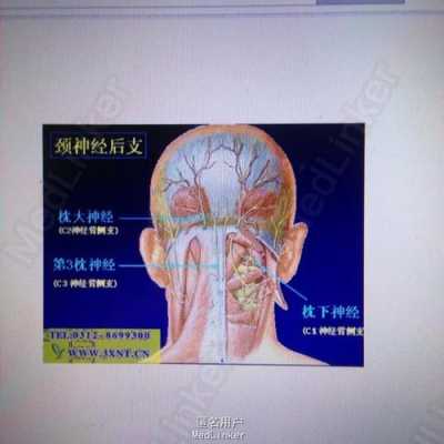孕期神经痛(孕期神经痛对胎儿有影响吗) 第1张 孕期神经痛(孕期神经痛对胎儿有影响吗) 第1张