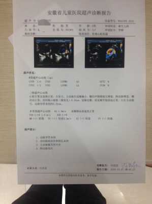 胎儿心脏超声检查多少钱(胎儿心脏彩超费用) 第1张 胎儿心脏超声检查多少钱(胎儿心脏彩超费用) 第1张