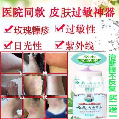 孕妇能用哪些止痒药,孕期过敏性皮炎瘙痒怎么办  第1张