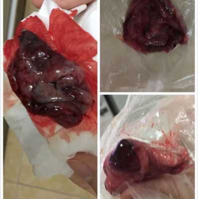 胎囊如何埋葬,流产胎儿埋在哪里好风水学 第2张 胎囊如何埋葬,流产胎儿埋在哪里好风水学 第2张