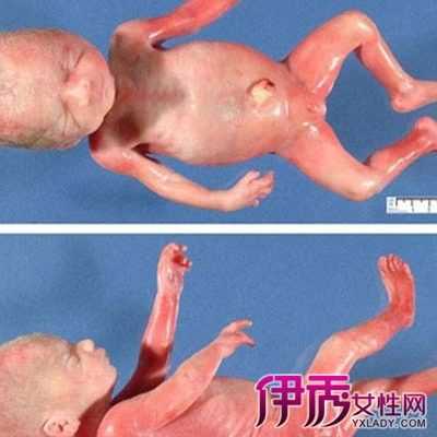 4个月的胎儿图(4个月的胎儿图片) 第2张 4个月的胎儿图(4个月的胎儿图片) 第2张