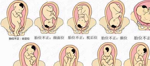 胎位RSA是什么意思,我不明白,孕期骶骨疼是怎么回事 第2张 胎位RSA是什么意思,我不明白,孕期骶骨疼是怎么回事 第2张