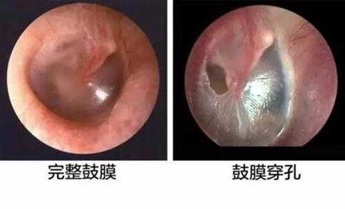 胎儿的耳膜(胎儿的耳膜什么时候发育) 第3张 胎儿的耳膜(胎儿的耳膜什么时候发育) 第3张