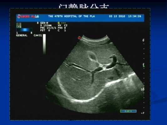 胎儿什么门(胎儿什么门?) 第1张 胎儿什么门(胎儿什么门?) 第1张