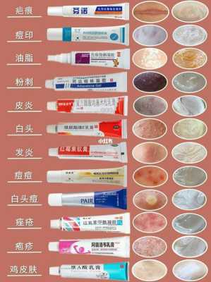 孕期长豆豆(孕期长豆豆可以用药膏吗) 第1张 孕期长豆豆(孕期长豆豆可以用药膏吗) 第1张