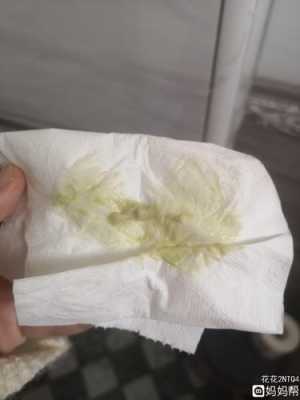 孕期白带黄绿(怀孕白带水黄绿色怎么办?孕初期白带水黄绿色是怎么回事) 第2张 孕期白带黄绿(怀孕白带水黄绿色怎么办?孕初期白带水黄绿色是怎么回事) 第2张