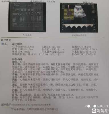 胎儿系统超声检查是什么(32周系统彩超检查什么) 第2张 胎儿系统超声检查是什么(32周系统彩超检查什么) 第2张