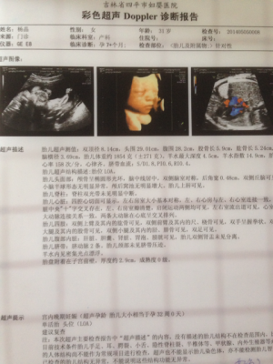 胎儿系统超声检查是什么(32周系统彩超检查什么) 第1张 胎儿系统超声检查是什么(32周系统彩超检查什么) 第1张