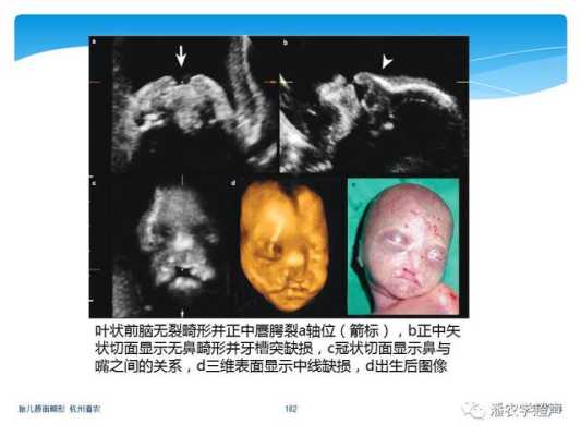 胎儿什么时候长眼睛(胎儿什么时候长眼睛鼻子) 第2张 胎儿什么时候长眼睛(胎儿什么时候长眼睛鼻子) 第2张