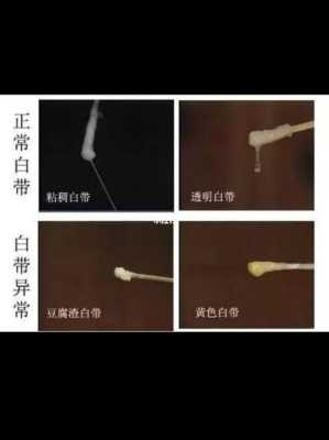 孕期白带水状(怀孕4个多月早上起来下面湿湿的感觉和流水似的,是怎么回事) 第1张 孕期白带水状(怀孕4个多月早上起来下面湿湿的感觉和流水似的,是怎么回事) 第1张
